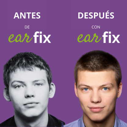 Earfix – Parche Corrector Invisible para Orejas Naturales